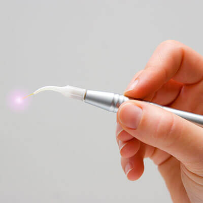 A hand holding a dental laser